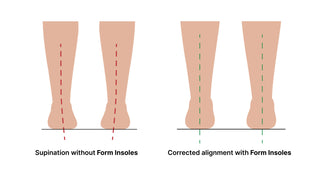 Supination – Form Insoles