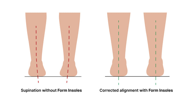 Supination – Form Insoles